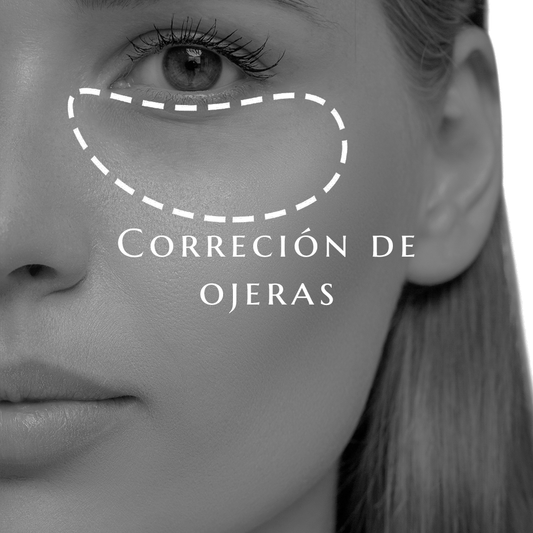 CORRECCIÓN DE OJERAS con AH con la Dra. Arboleda