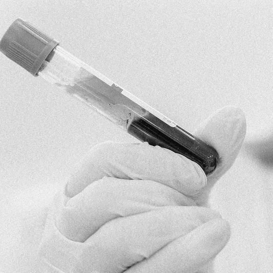 Biorevitalización con factores de crecimiento
